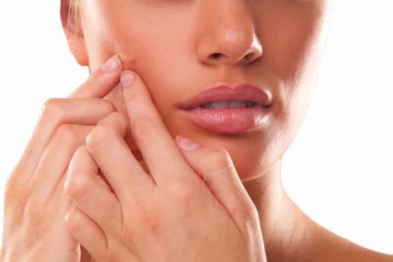 Treating Oily Skin with 6 Simple and Effective Beauty Tips