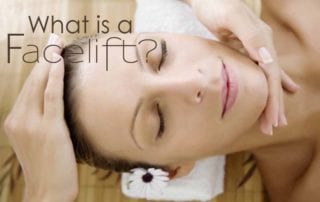 What is a Facelift?
